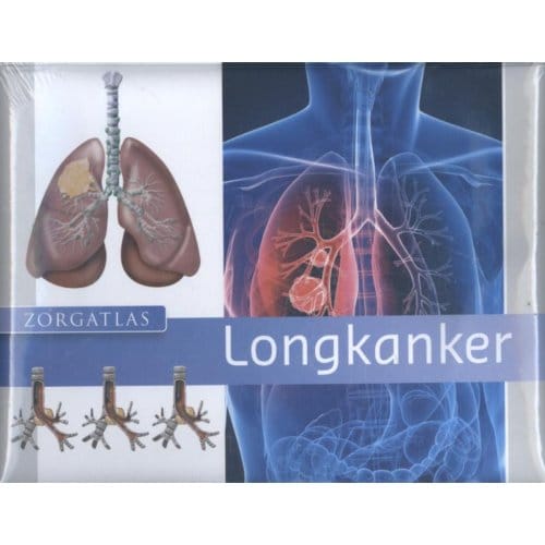 Longkanker - Zorgatlas - Sander de Hosson