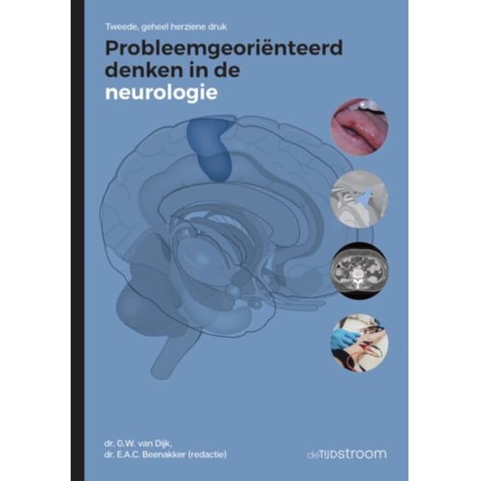 Probleemgeoriënteerd Denken In De Neurologie