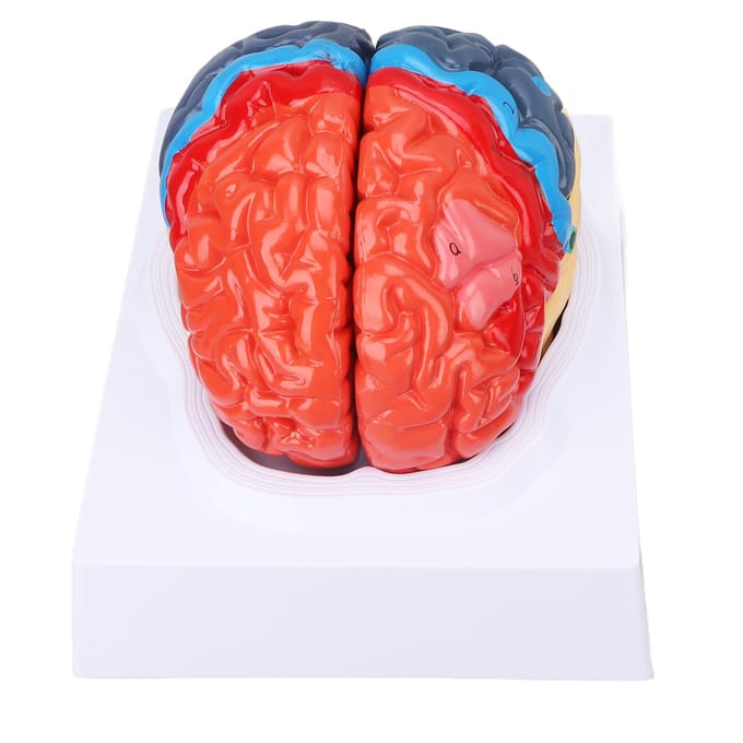 Anatomisch Menselijk Hersenenmodel Cerebrale Artery Kleur Gedeeld Links Rechts Hersenen Gemonteerd Model voor red