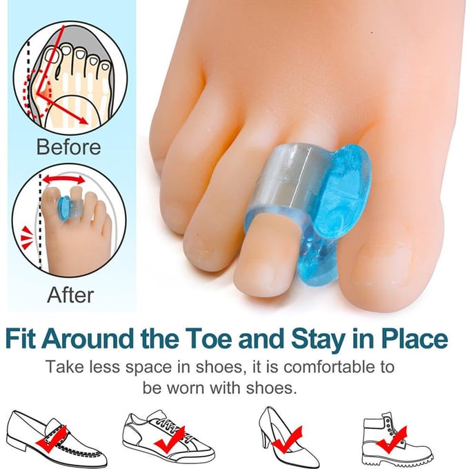 3 Paar Zachte Bunion Spreiders Silicone Gel Teenspreider Duim Corrector Voetverzorgingstool blauw