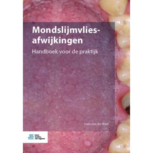Mondslijmvliesafwijkingen - Isaäc van der Waal