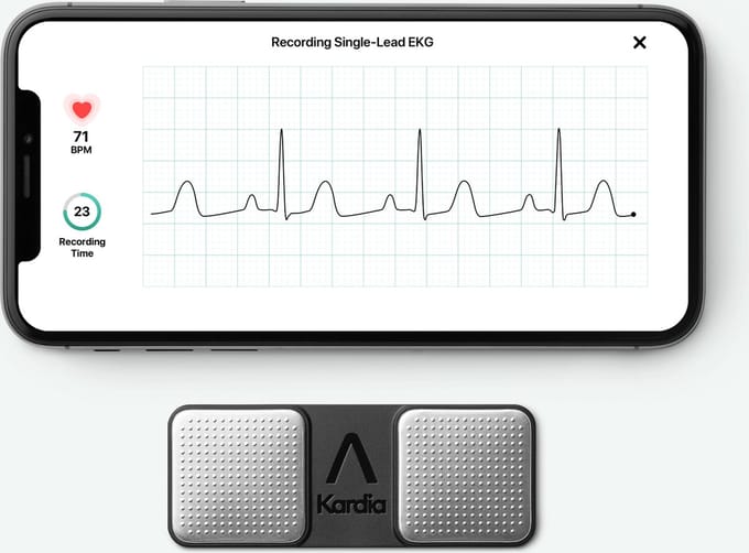 Kardia Mobile 1 kanaals ECG meter - Alivecor