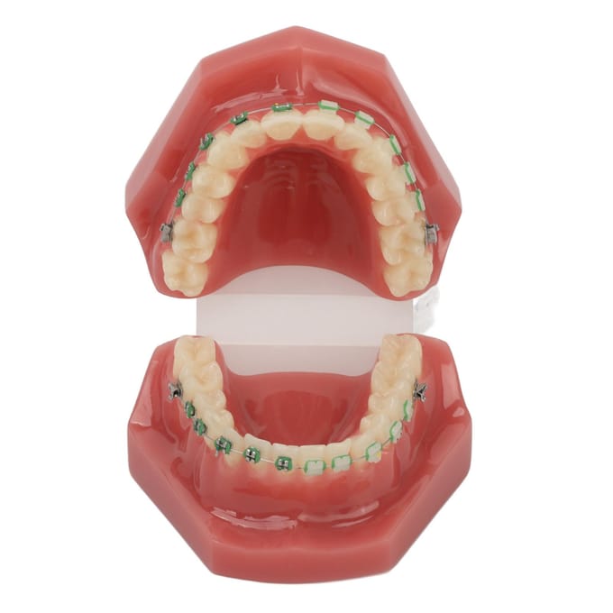 Modèle de démonstration orthodontique dentaire Modèle de dents avec fils métalliques et bracket pour l'enseignement brown