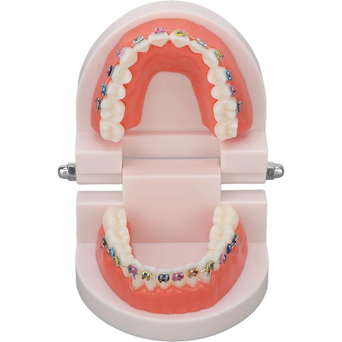 Modèle de dents typodont dentaire avec bracket métallique orthodontique pour enseignement et recherche dentaire white