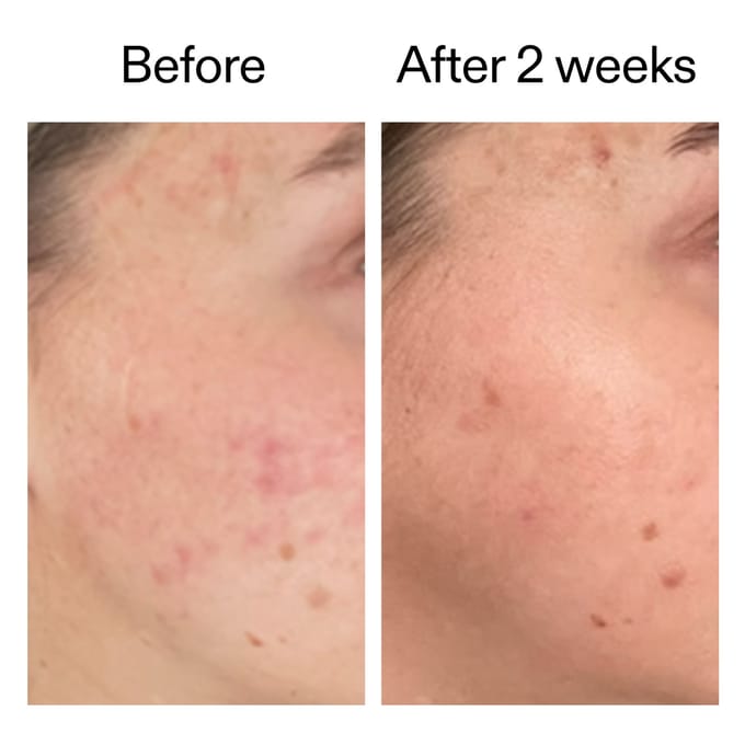 The INKEY List 360 Skin Clearing Serum 30ml