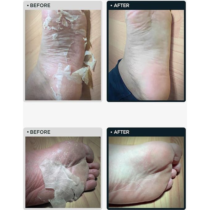 TOSOWOONG Voet Peeling Mask Pack 2 stuks gray