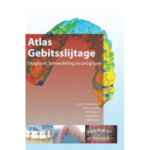Atlas Gebitsslijtage